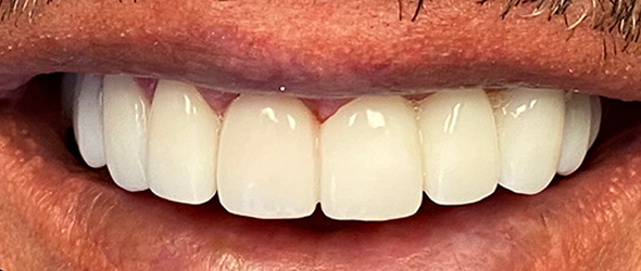  before and after images of dental