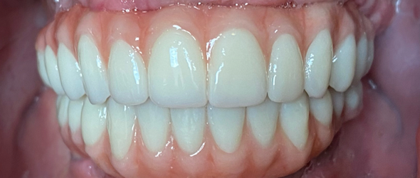  before and after images of dental