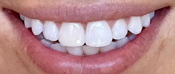  before and after images of dental