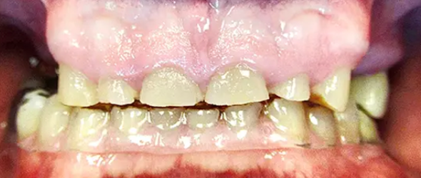  before and after images of dental