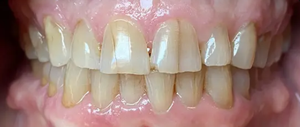  before and after images of dental