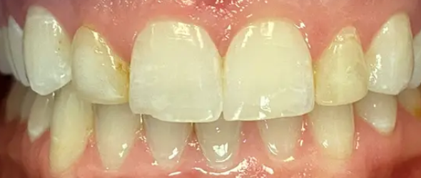  before and after images of dental