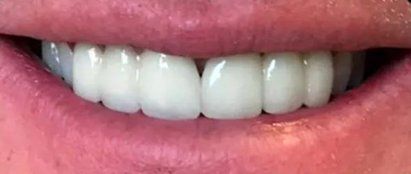  before and after images of dental