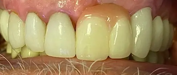  before and after images of dental