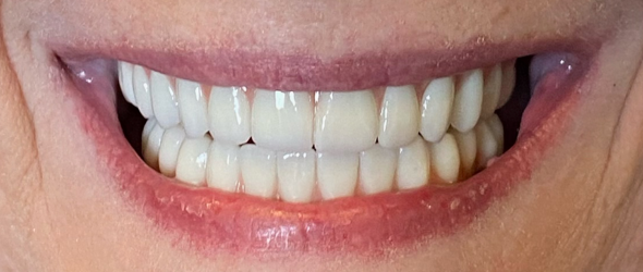  before and after images of dental