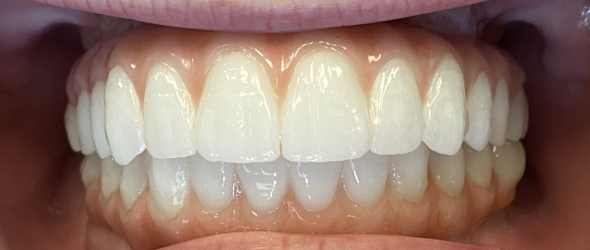  before and after images of dental