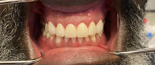  before and after images of dental