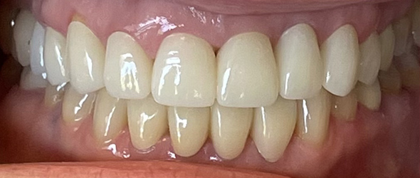  before and after images of dental
