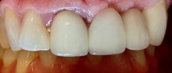  before and after images of dental