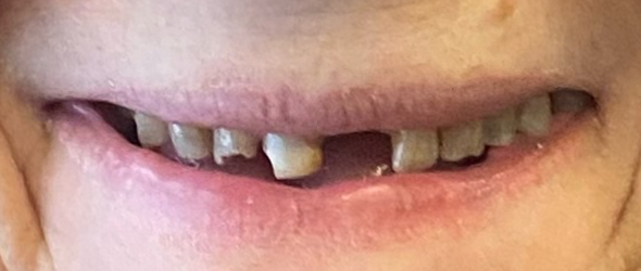  before and after images of dental