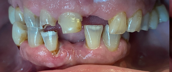  before and after images of dental