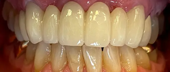  before and after images of dental