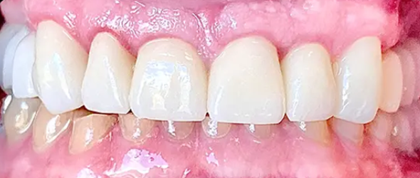  before and after images of dental