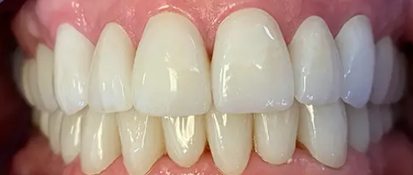  before and after images of dental