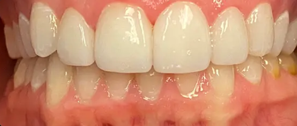  before and after images of dental