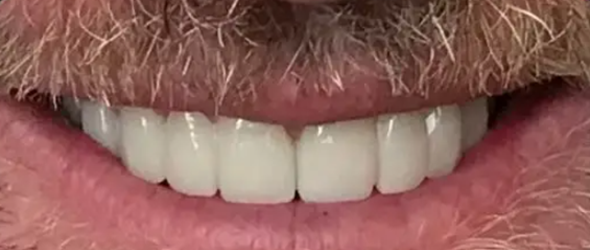  before and after images of dental