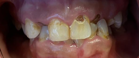  before and after images of dental