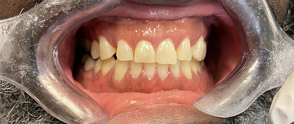  before and after images of dental