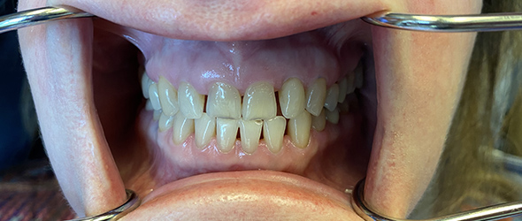  before and after images of dental