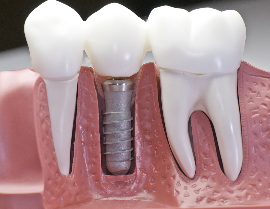 Ken Caryl Dentistry Ken Caryl Dentistry