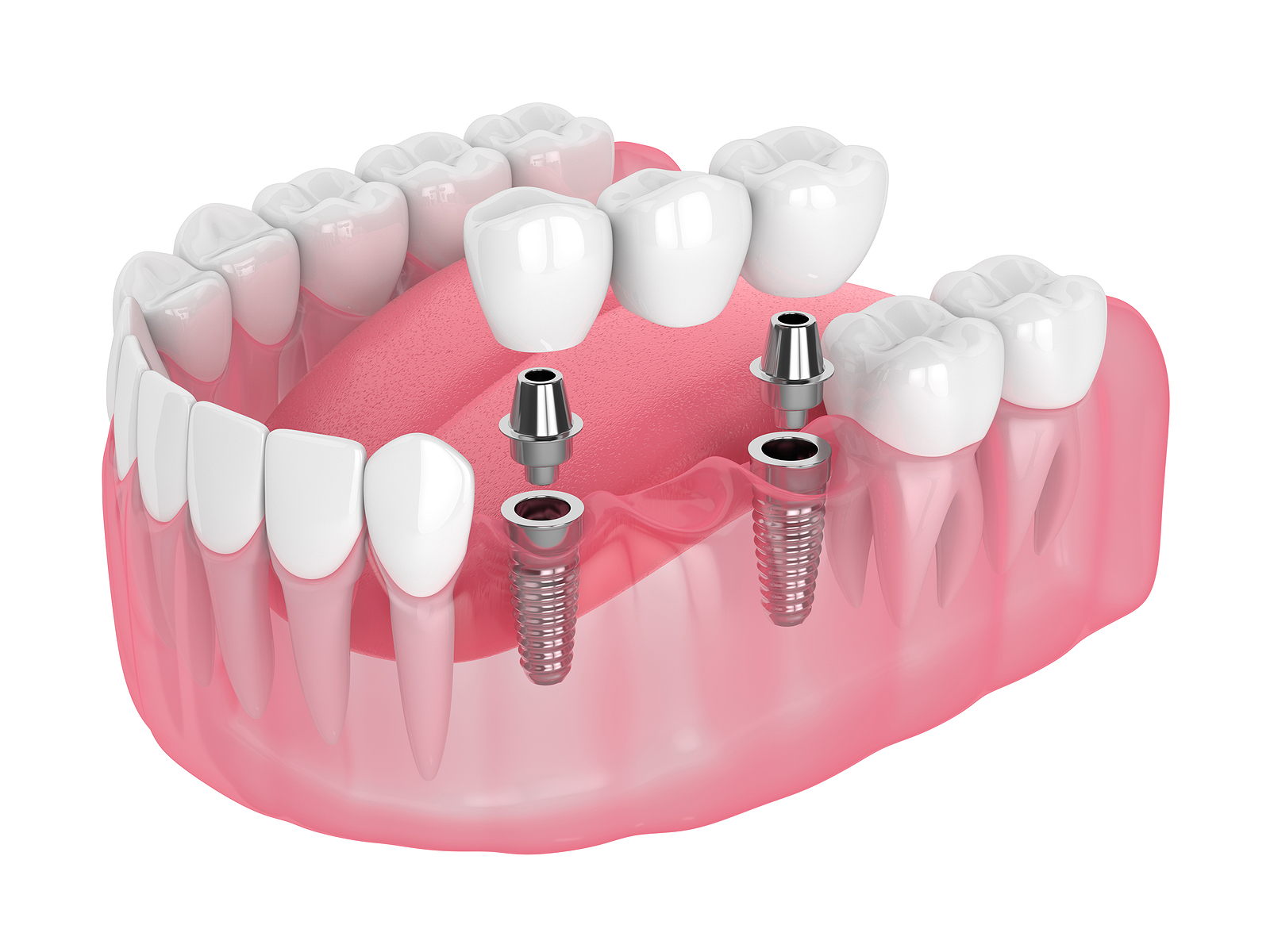 Ken Caryl Dentistry Ken Caryl Dentistry