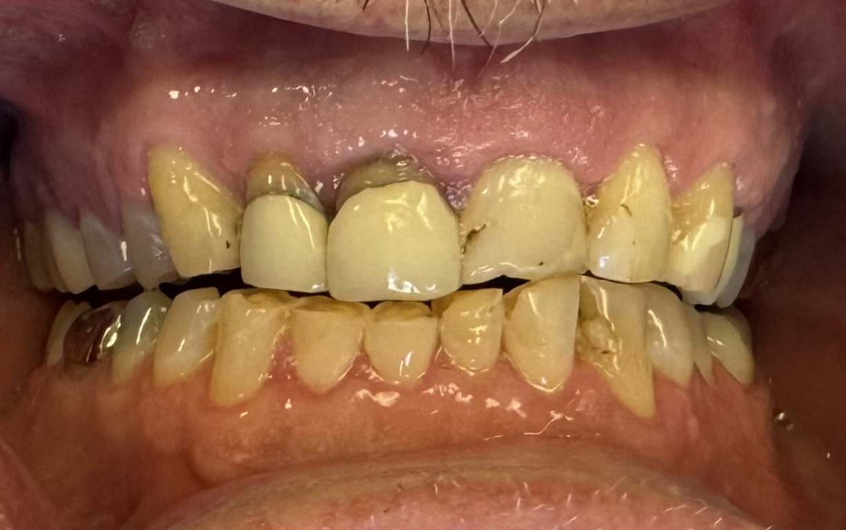  before and after images of dental