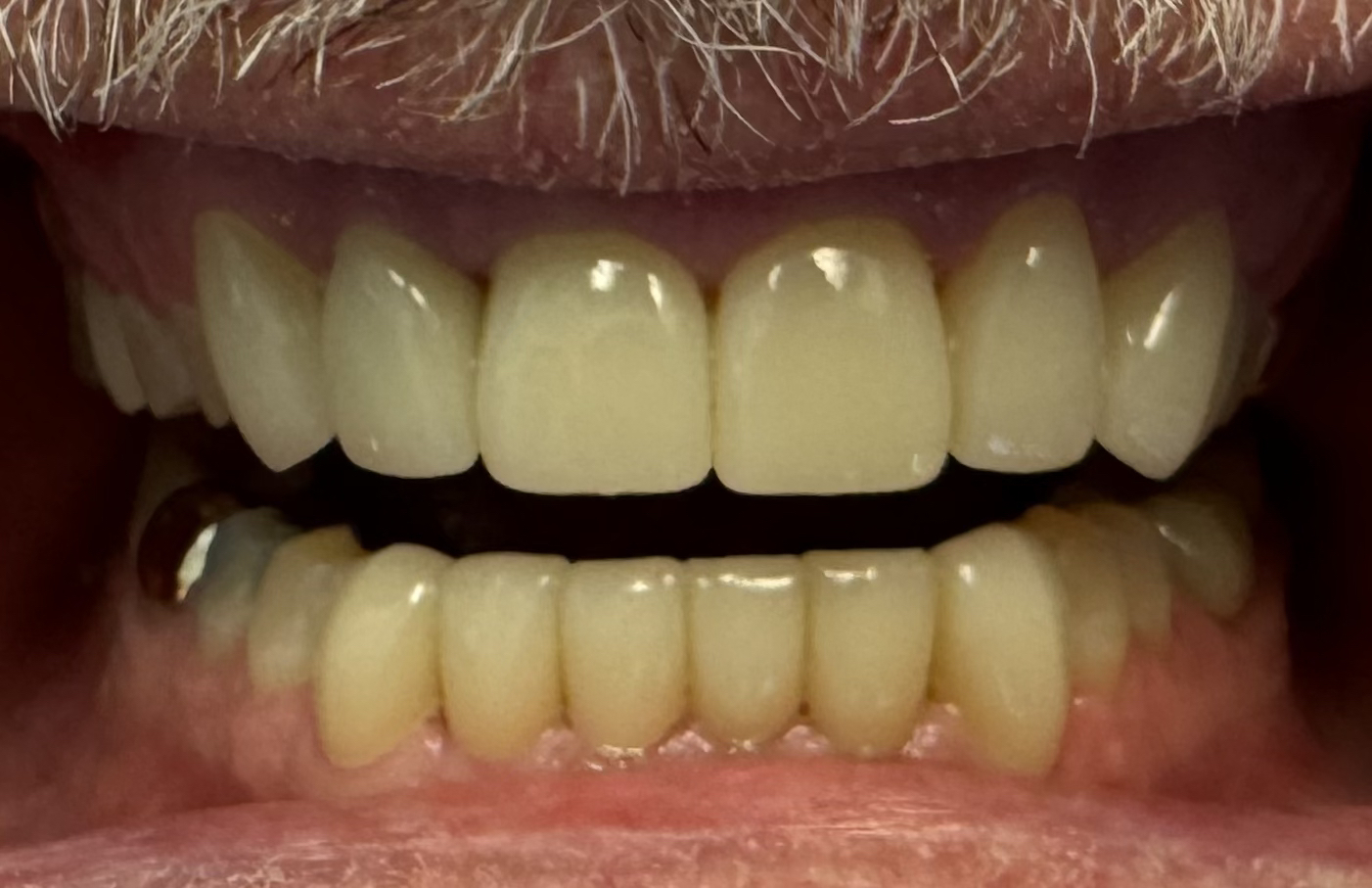  before and after images of dental
