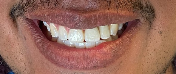  before and after images of dental