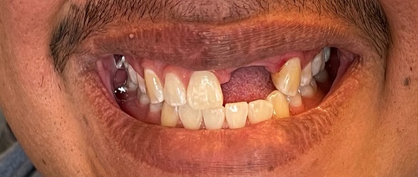  before and after images of dental