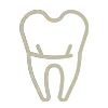 Root Canal Therapy Root Canal Therapy