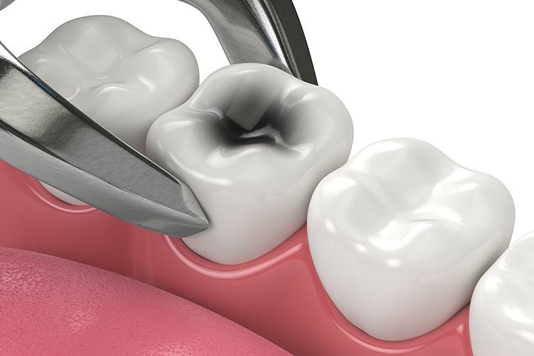 Ken Caryl Dentistry Ken Caryl Dentistry